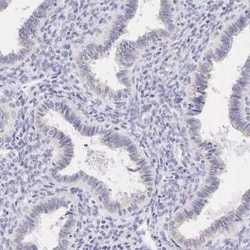 Cytokeratin 17 Antibody, Novus Biologicals 0.1 mL; Unconjugated:Antibodies,