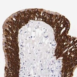 Cytokeratin 17 Antibody, Novus Biologicals 0.1 mL; Unconjugated:Antibodies,