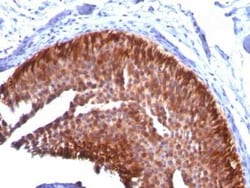 Cytokeratin 17 Antibody (KRT17/778), Novus Biologicals 0.02mg; Unlabeled:Antibodies,
