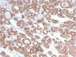 Cytokeratin 18 Antibody (KRT18/2808R) - Azide and BSA Free, Novus Biologicals 100 &mu;g | Buy Online | Novus Biologicals | Fisher Scientific