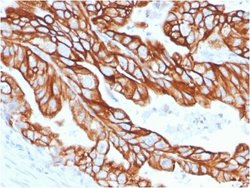Cytokeratin 18 Antibody (KRT18/2808R) - Azide and BSA Free, Novus Biologicals 100 &mu;g | Buy Online | Novus Biologicals | Fisher Scientific