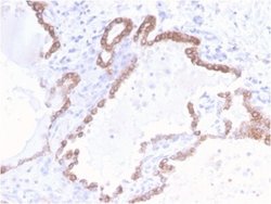 Cytokeratin 18 Antibody (KRT18/2808R) - Azide and BSA Free, Novus Biologicals 100 &mu;g | Buy Online | Novus Biologicals | Fisher Scientific