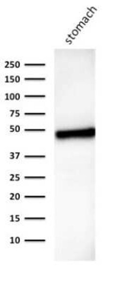 Cytokeratin 18 Antibody (B23.1), Novus Biologicals:Antibodies:Primary Antibodies
