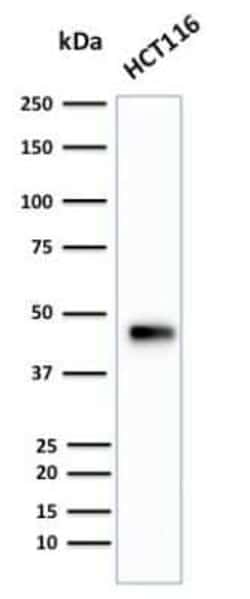 Cytokeratin 18 Antibody (B23.1), Novus Biologicals:Antibodies:Primary Antibodies