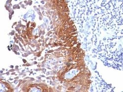 Cytokeratin 18 Antibody (Cocktail), Novus Biologicals:Antibodies:Primary