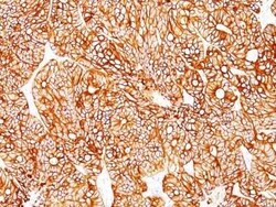 Cytokeratin 18 Antibody (Cocktail), Novus Biologicals:Antibodies:Primary