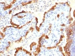 Cytokeratin 18 Antibody (Cocktail), Novus Biologicals:Antibodies:Primary