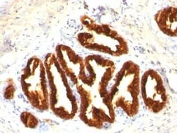 Cytokeratin 18 Antibody (Cocktail), Novus Biologicals:Antibodies:Primary