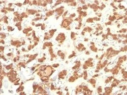 Cytokeratin 18 Antibody (Cocktail), Novus Biologicals:Antibodies:Primary