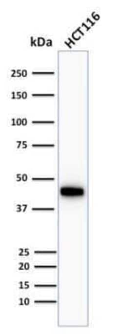 Cytokeratin 18 Antibody (Cocktail), Novus Biologicals:Antibodies:Primary