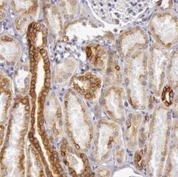 Cytokeratin 18 Antibody, Novus Biologicals 25 &mu;L | Buy Online | Novus Biologicals | Fisher Scientific