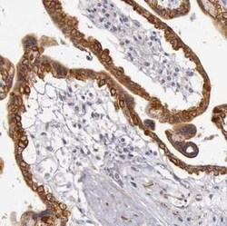 Cytokeratin 18 Antibody, Novus Biologicals 25 &mu;L | Buy Online | Novus Biologicals | Fisher Scientific