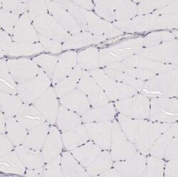 Cytokeratin 18 Antibody, Novus Biologicals 25 &mu;L | Buy Online | Novus Biologicals | Fisher Scientific