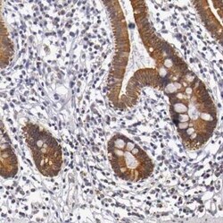 Cytokeratin 18 Antibody, Novus Biologicals 25 &mu;L | Buy Online | Novus Biologicals | Fisher Scientific