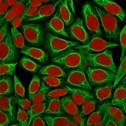 Cytokeratin 18 Antibody (KRT18/1190), Novus Biologicals 0.02mg; Unlabeled:Antibodies,
