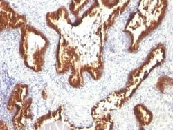 Cytokeratin 18 Antibody (KRT18/1190), Novus Biologicals 0.02mg; Unlabeled:Antibodies,