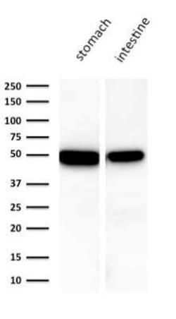 Cytokeratin 18 Antibody (KRT18/1190), Novus Biologicals 0.02mg; Unlabeled:Antibodies,
