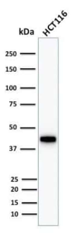Cytokeratin 18 Antibody (KRT18/1190), Novus Biologicals 0.02mg; Unlabeled:Antibodies,
