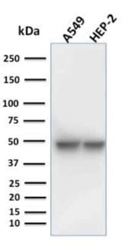 Cytokeratin 18 Antibody (KRT18/1190), Novus Biologicals 0.02mg; Unlabeled:Antibodies,