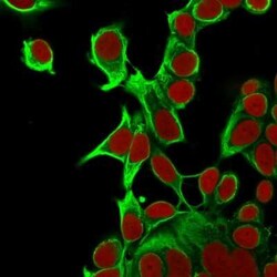 Cytokeratin 18 Antibody (KRT18/835), Novus Biologicals:Antibodies:Primary