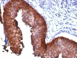 Cytokeratin 18 Antibody (KRT18/835), Novus Biologicals:Antibodies:Primary