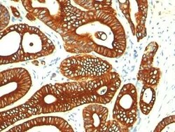 Cytokeratin 18 Antibody (KRT18/835), Novus Biologicals:Antibodies:Primary