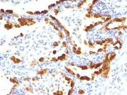 Cytokeratin 18 Antibody (KRT18/835), Novus Biologicals:Antibodies:Primary