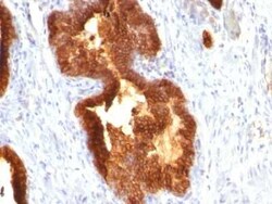 Cytokeratin 18 Antibody (KRT18/835), Novus Biologicals:Antibodies:Primary