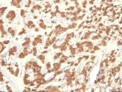 Cytokeratin 18 Antibody (KRT18/835), Novus Biologicals:Antibodies:Primary