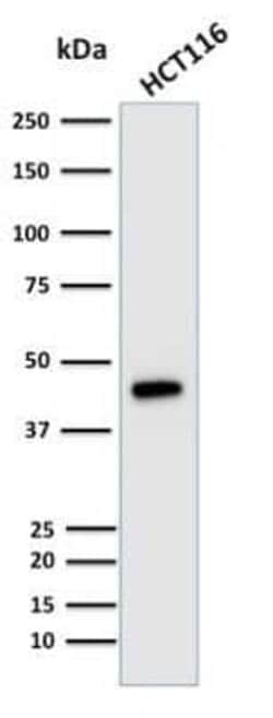Cytokeratin 18 Antibody (KRT18/835), Novus Biologicals:Antibodies:Primary