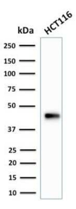 Cytokeratin 18 Antibody (SPM265) - Azide and BSA Free, Novus Biologicals