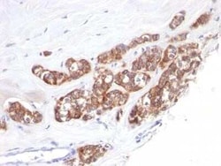 Cytokeratin 18 Antibody (SPM510) - Azide and BSA Free, Novus Biologicals