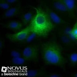 Cytokeratin 19 Antibody (A53-B/A2.26), Novus Biologicals 0.1mg; Unlabeled:Antibodies,