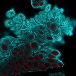 Cytokeratin 19 Antibody (A53-B/A2.26), Novus Biologicals 0.1mg; Unlabeled:Antibodies,