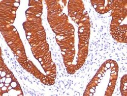 Cytokeratin 19 Antibody (A53-B/A2.26), Novus Biologicals 0.1mg; Unlabeled:Antibodies,