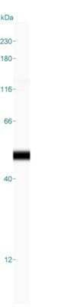 Cytokeratin 19 Antibody (A53-B/A2.26), Novus Biologicals 0.1mg; Unlabeled:Antibodies,