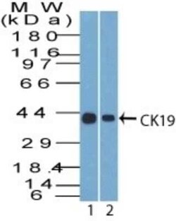 Cytokeratin 19 Antibody (A53-B/A2.26), Novus Biologicals 0.1mg; Unlabeled:Antibodies,