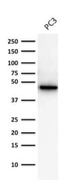 Cytokeratin 19 Antibody (A53-B/A2.26), Novus Biologicals 0.1mg; Unlabeled:Antibodies,