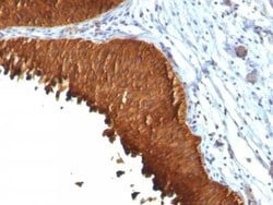 Cytokeratin 19 Antibody (KRT19/799 + KRT19/800), Novus Biologicals 0.02mg;