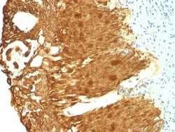 Cytokeratin 19 Antibody (KRT19/799 + KRT19/800), Novus Biologicals 0.02mg;