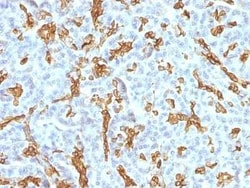 Cytokeratin 19 Antibody (KRT19/799 + KRT19/800), Novus Biologicals 0.02mg;