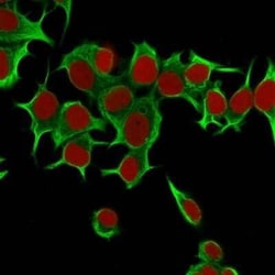 Cytokeratin 19 Antibody (KRT19/799), Novus Biologicals:Antibodies:Primary