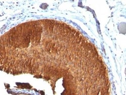 Cytokeratin 19 Antibody (KRT19/799), Novus Biologicals:Antibodies:Primary