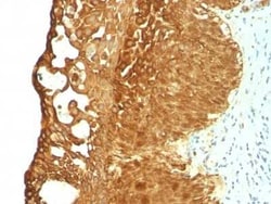 Cytokeratin 19 Antibody (KRT19/799), Novus Biologicals:Antibodies:Primary