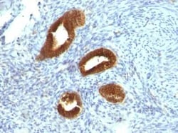 Cytokeratin 19 Antibody (KRT19/799), Novus Biologicals:Antibodies:Primary