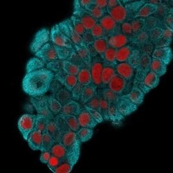 Cytokeratin 19 Antibody (KRT19/800) - Azide and BSA Free, Novus Biologicals