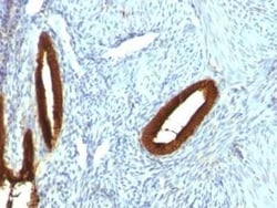 Cytokeratin 19 Antibody (KRT19/800) - Azide and BSA Free, Novus Biologicals