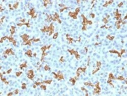 Cytokeratin 19 Antibody (KRT19/800) - Azide and BSA Free, Novus Biologicals