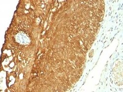 Cytokeratin 19 Antibody (KRT19/800) - Azide and BSA Free, Novus Biologicals