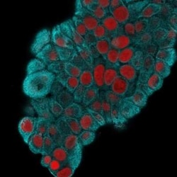 Cytokeratin 19 Antibody (KRT19/800), Novus Biologicals 0.1mg; Unlabeled:Antibodies,